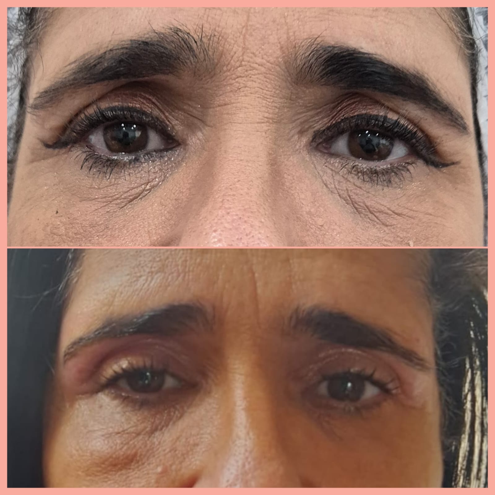 Jato de Plasma — antes e depois